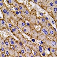 Polyclonal Rabbit anti-Human HLA-A Antibody (IHC, IF, WB)