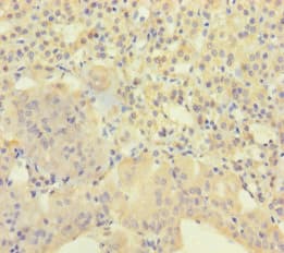 AGRP Antibody