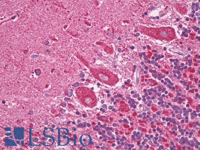 IHC-plus™ SOGA1 Antibody