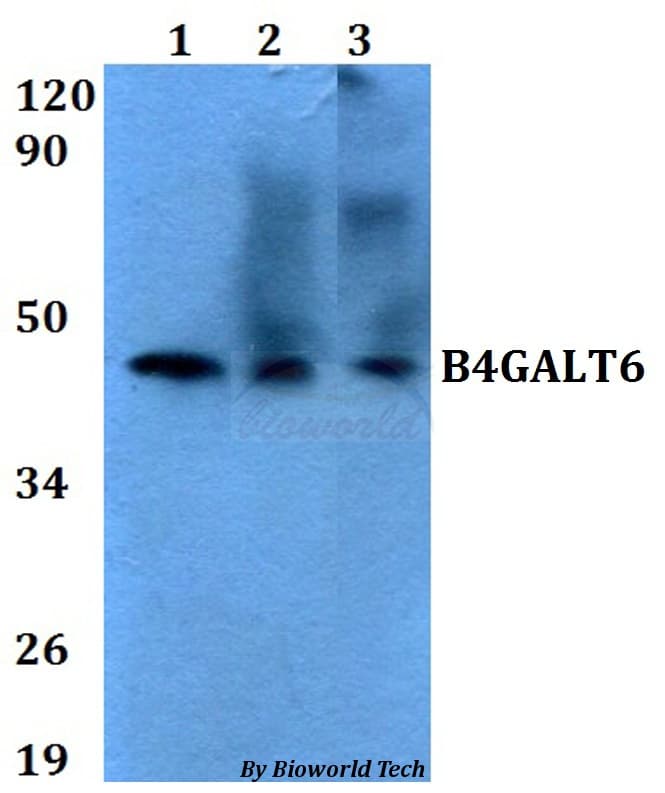 Polyclonal Rabbit anti-Human B4GALT6 Antibody (WB)