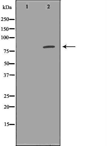 CEACAM5 / CD66e Antibody