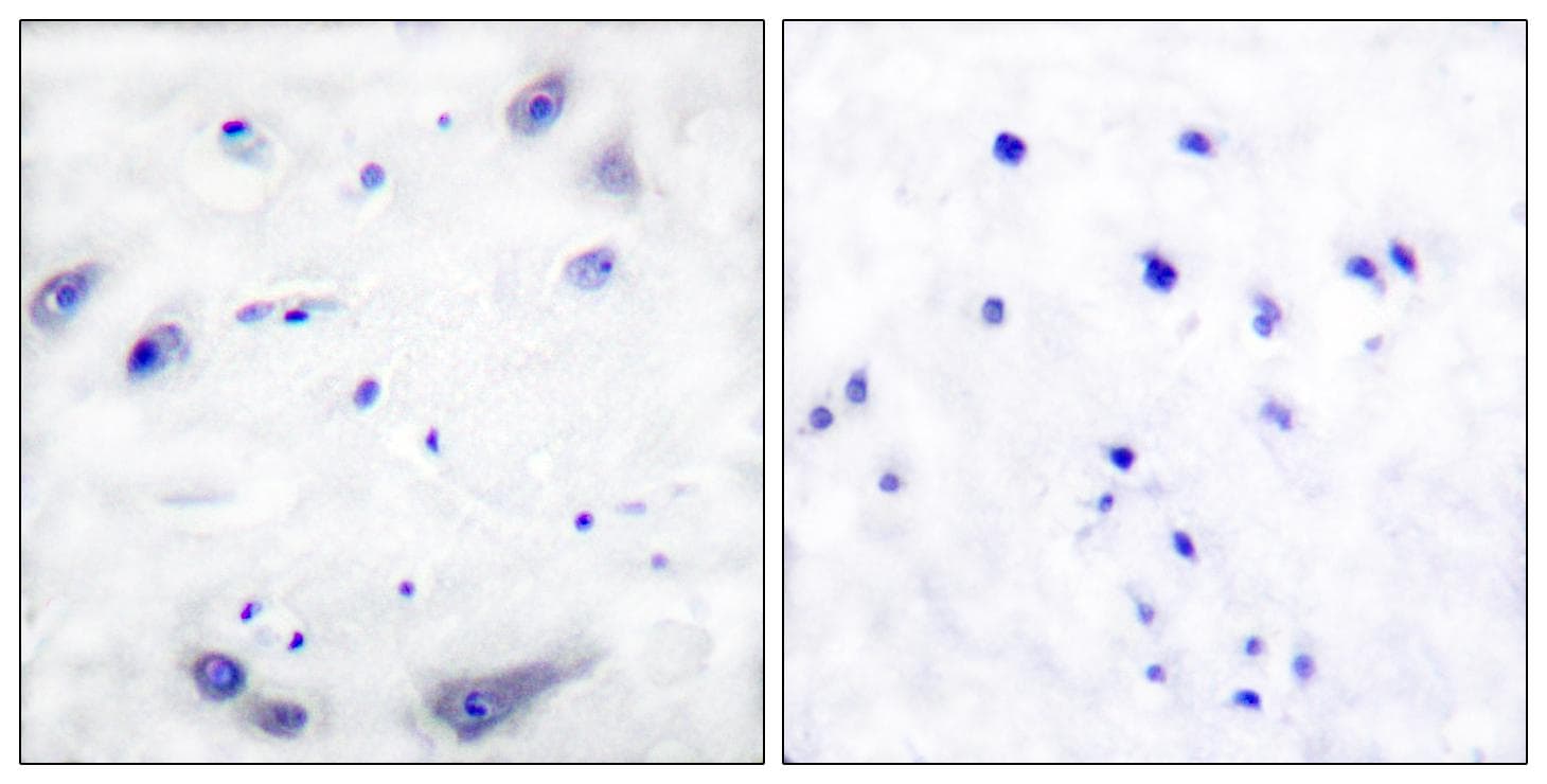 TH / Tyrosine Hydroxylase Antibody (p31)