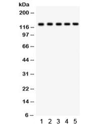 DAXX Antibody