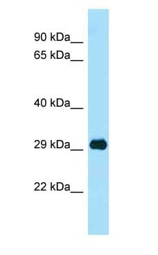 PHB / Prohibitin Antibody (aa185-234)