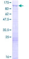 Human NSD3 / WHSC1L1 Protein (Recombinant GST)