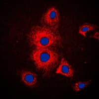 IHC-plus™ KRT19 / CK19 / Cytokeratin 19 Antibody (Internal)