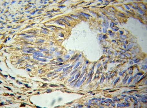 Polyclonal Rabbit anti-Human GFAP Antibody (IHC, WB)