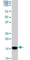 NME2 Antibody (clone 1D3)