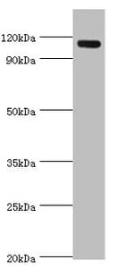 AMOT / Angiomotin Antibody (aa1-300)