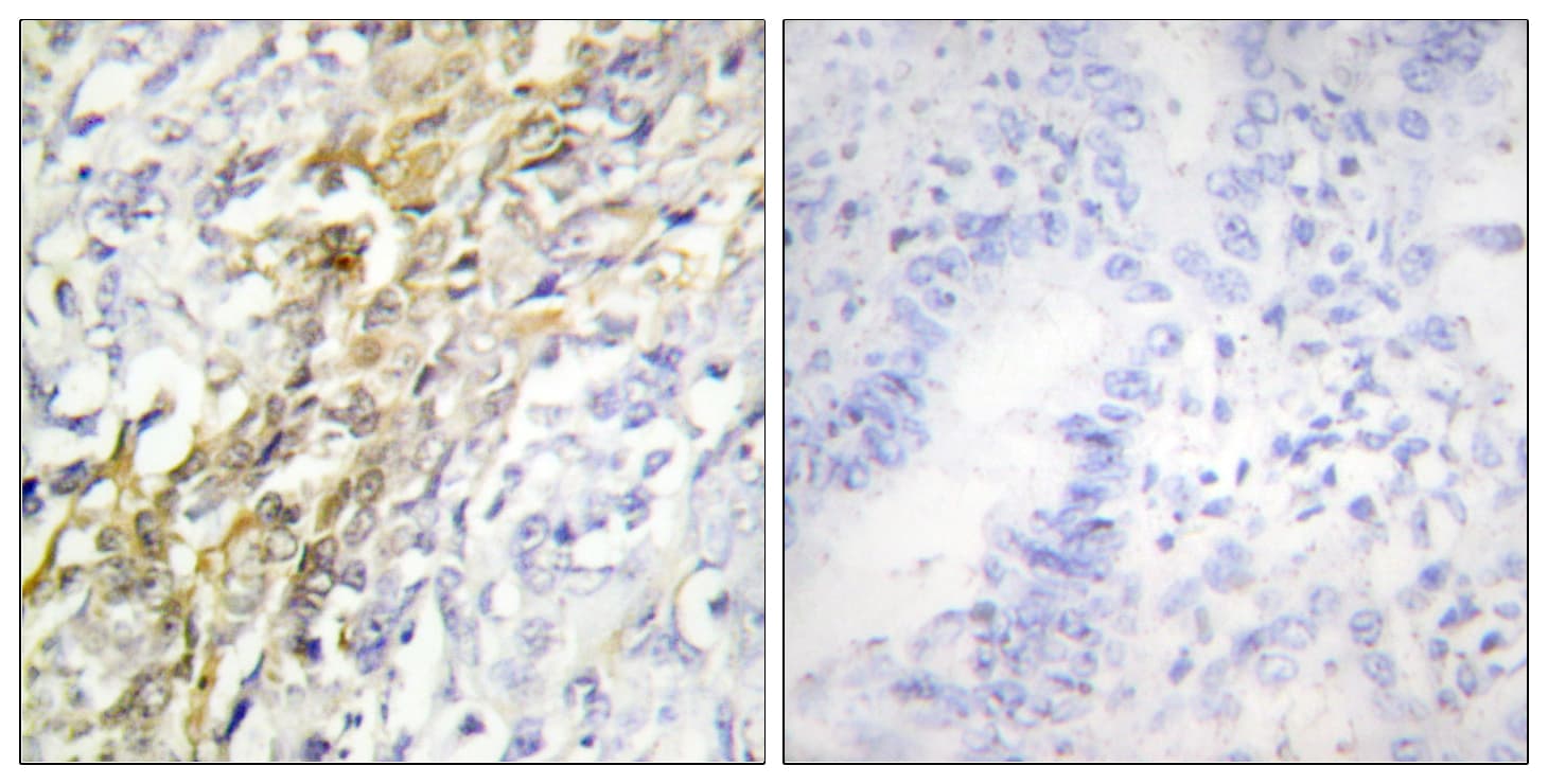 Polyclonal Rabbit anti-Human CSNK1A1 / CK1 Alpha Antibody (aa126-175, IHC, IF, WB)