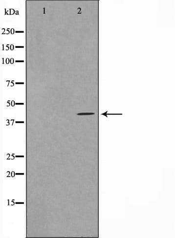 VPS72 Antibody