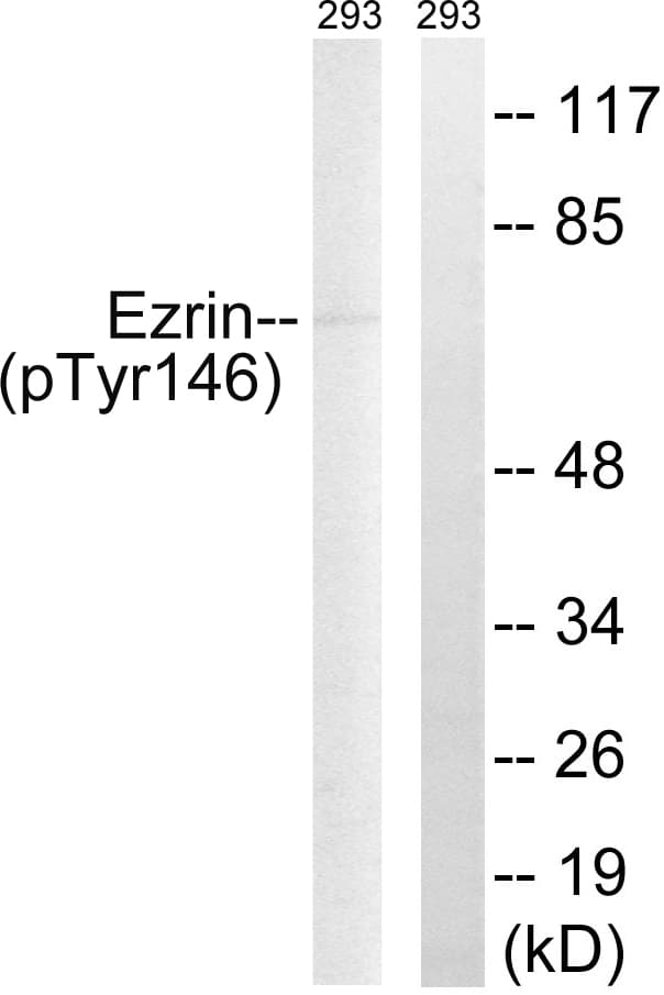 Polyclonal Rabbit anti-Human EZR / Ezrin Antibody (phospho-Tyr146, WB)