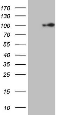 ECT2 Antibody (aa175-438, clone OTI2D9)