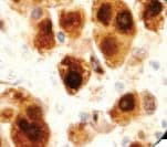S100 Protein Antibody (clone 4C4.9, Ready-to-Use)