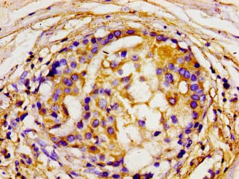 DLG2 / PSD93 Antibody