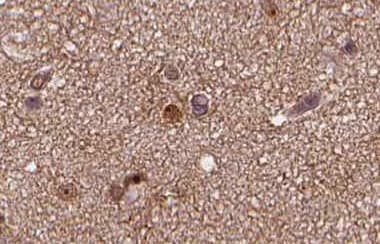 Polyclonal Rabbit anti-Human SNAP25 Antibody (IHC, IF, WB)