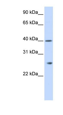 GSTK1 Antibody (aa36-85)