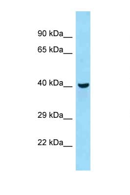 Polyclonal Rabbit anti-Mouse QTRTD1 Antibody (aa189-238, WB)