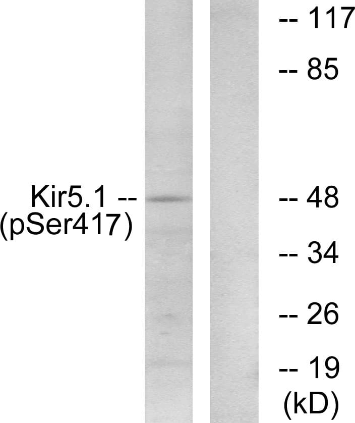 Polyclonal Rabbit anti-Mouse KCNJ16 / Kir5.1 Antibody (phospho-Ser417, IHC, IF, WB)