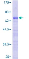 Human LMOD1 Protein (Recombinant GST)