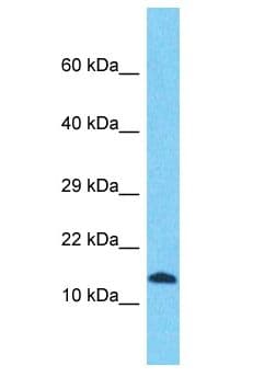 SFT2D2 Antibody (aa4-53)