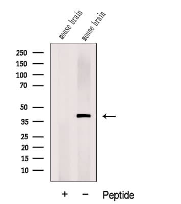 DNAJB12 Antibody