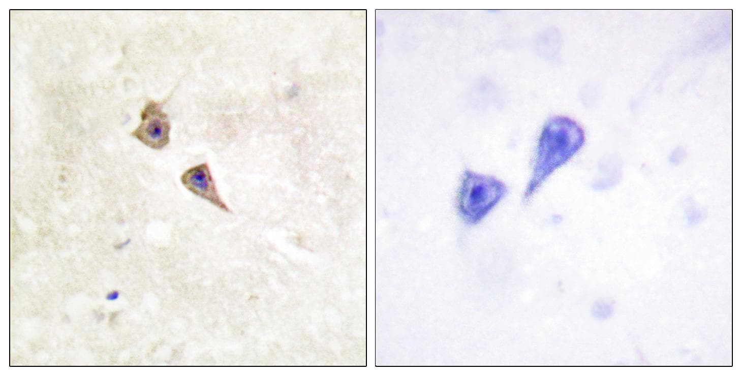 Polyclonal Rabbit anti-Human IFNAR1 / IFNAR Antibody (phospho-Tyr466, IHC)