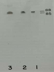 KLKB1 / Plasma Kallikrein Antibody (clone 13G11)