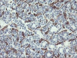 PECAM-1 / CD31 Antibody (clone OTI3G4)