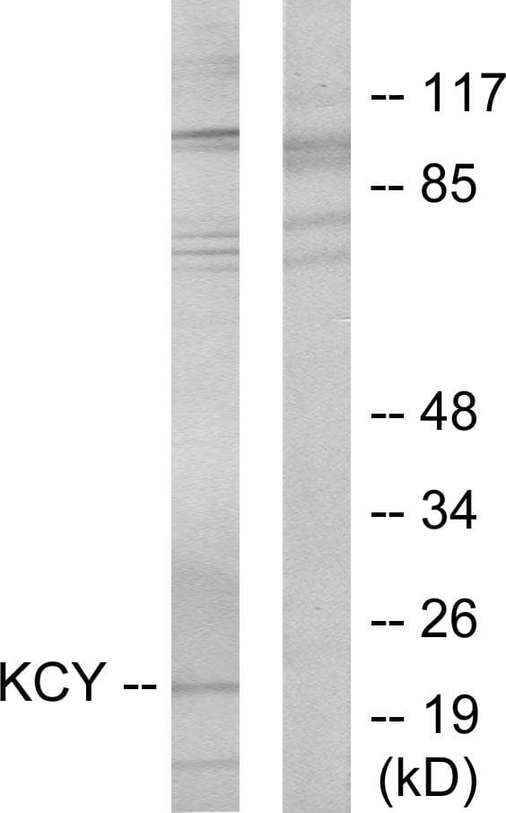 CMPK / CMPK1 Antibody