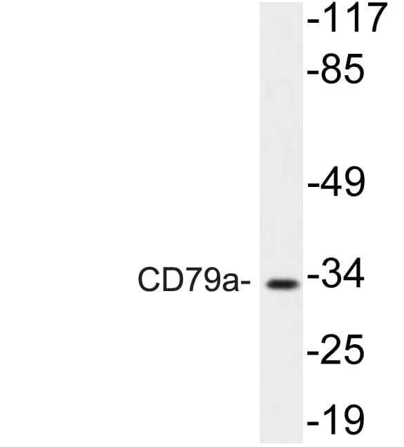 CD79A / CD79 Alpha Antibody (aa154-203)