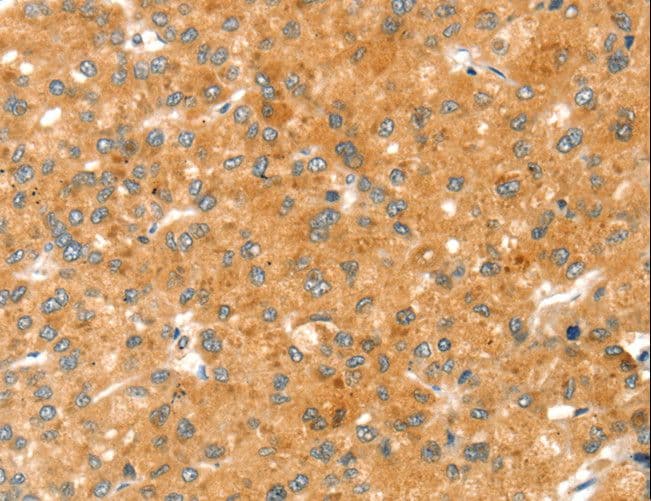 Polyclonal Rabbit anti-Human RAB27A / RAB27 Antibody (IHC, WB)