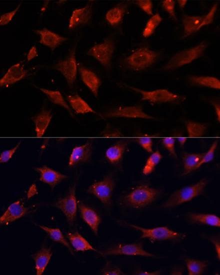 DNASE1L1 Antibody