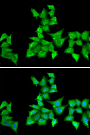 HAPLN1 Antibody