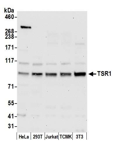 TSR1 Antibody (aa475-525)