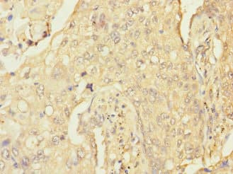 Polyclonal Rabbit anti-Human RGS9 Antibody (IHC)