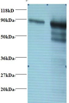 TF / Transferrin Antibody (Biotin)