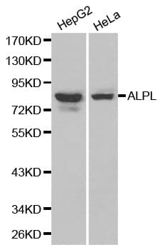 Polyclonal Rabbit anti-Human ALPL / Alkaline Phosphatase Antibody (IHC, WB)