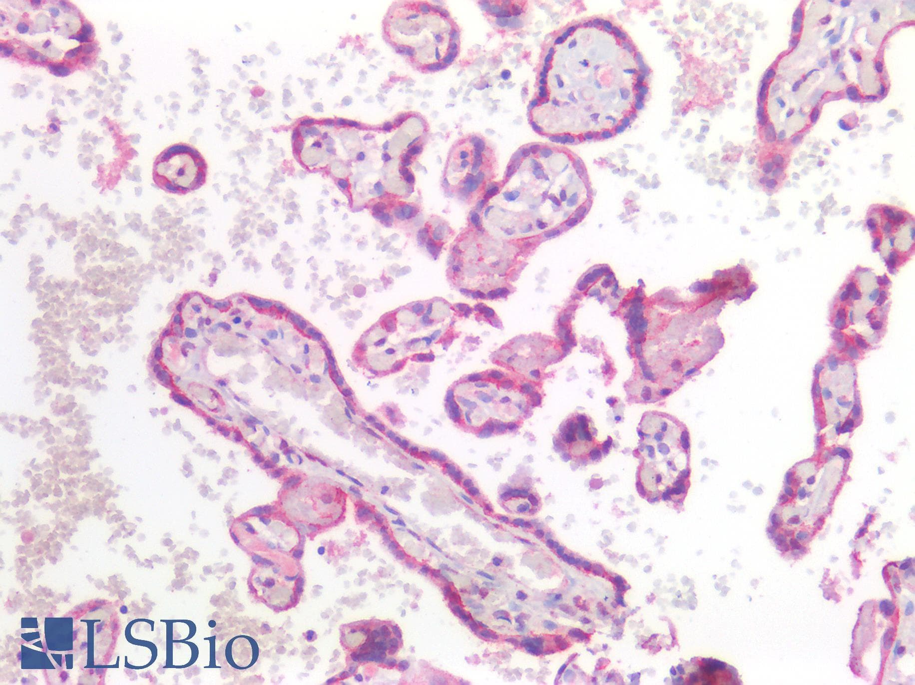 Monoclonal Mouse anti-Human CDH1 / E Cadherin Antibody (aa373-621, IHC, WB)