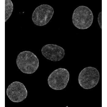 Polyclonal Rabbit anti-Mouse UNC84B / SUN2 Antibody (IF, WB)