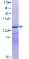 Human SYNGAP Protein (Recombinant GST, N-terminus)