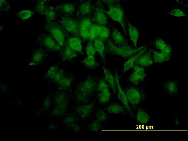 IHC-plus™ RELA / NFKB p65 Antibody (clone 8G3)