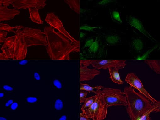 IRF6 Antibody (clone UMAB106, Carrier-free)