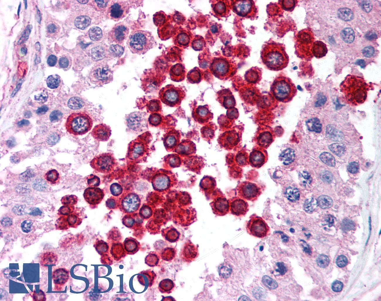 IHC-plus™ ATM Antibody (aa2577-3056, clone 2C1)