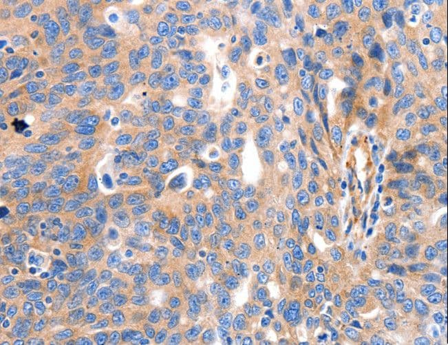 Polyclonal Rabbit anti-Human IGFBP7 / TAF Antibody (IHC)
