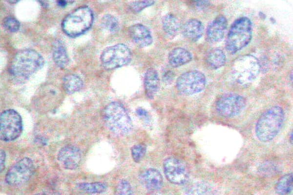 RPS6KB1 / P70S6K / S6K Antibody (Phe438)