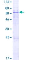Human LPGAT1 Protein (Recombinant GST)