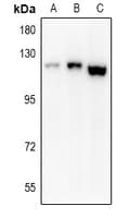 EPHA8 / EPH Receptor A8 Antibody