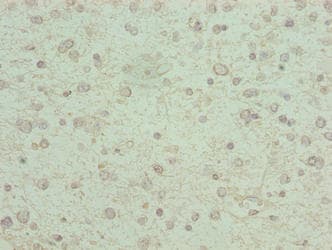 Polyclonal Rabbit anti-Human KCNK13 / THIK-1 Antibody (IHC, WB)