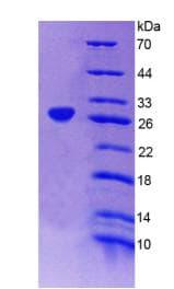Human BCO1 / BCMO1 Protein (Recombinant His, N-Terminal)